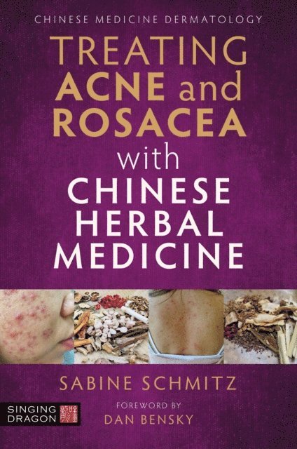 Sabine Schmitz - Treating Acne and Rosacea with Chinese Herbal Medicine, E-bok