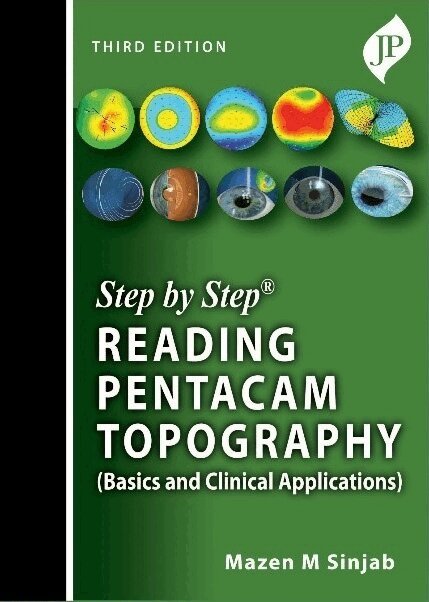 Mazen M Sinjab - Step by Step: Reading Pentacam Topography, Häftad