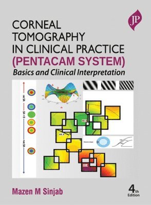 Mazen M Sinjab - Corneal Tomography in Clinical Practice (Pentacam System), Inbunden