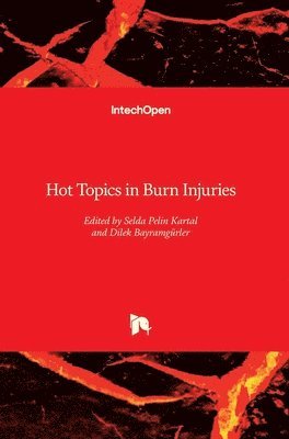Selda Pelin Kartal, Dilek Bayramgürler - Hot Topics in Burn Injuries, Inbunden. Tillgänglighet: Lägg i varukorg