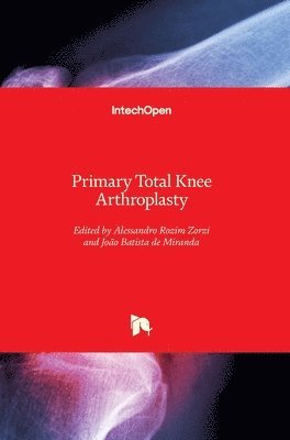 Alessandro Rozim Zorzi, João Batista de Miranda - Primary Total Knee Arthroplasty, Inbunden