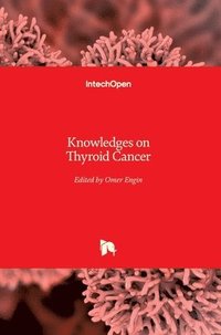 Knowledges on Thyroid Cancer