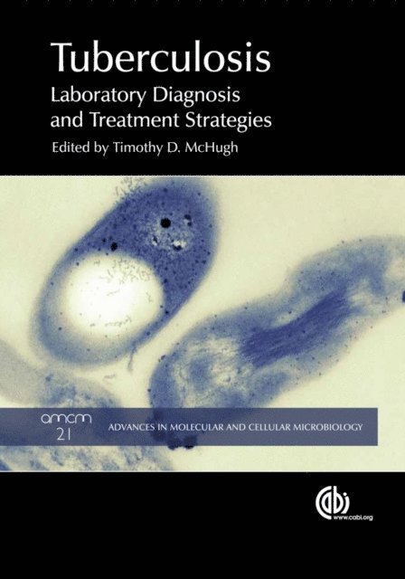Timothy D. McHugh - Tuberculosis, E-bok