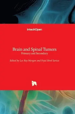 Lee Roy Morgan, Feyzi Birol Sarica - Brain and Spinal Tumors, Inbunden. Tillgänglighet: Lägg i varukorg