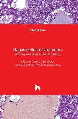Costin Teodor Streba, Cristin Constantin Vere, Ion Rogoveanu - Hepatocellular Carcinoma, Inbunden. Tillgänglighet: Lägg i varukorg