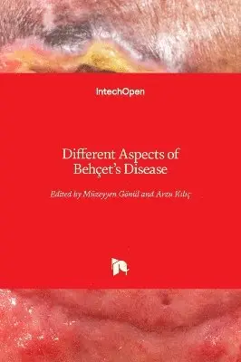 Müzeyyen Gönül, Arzu Kılıç - Different Aspects of Behçet's Disease, Inbunden. Tillgänglighet: Lägg i varukorg