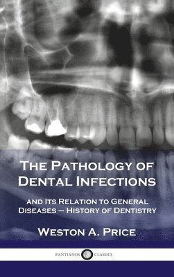 Weston a Price - Pathology of Dental Infections, Inbunden