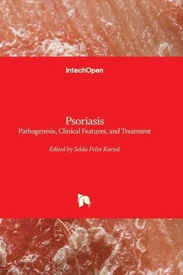 Selda Pelin Kartal, Selda Pelin Kartal - Psoriasis, Inbunden. Tillgänglighet: Lägg i varukorg