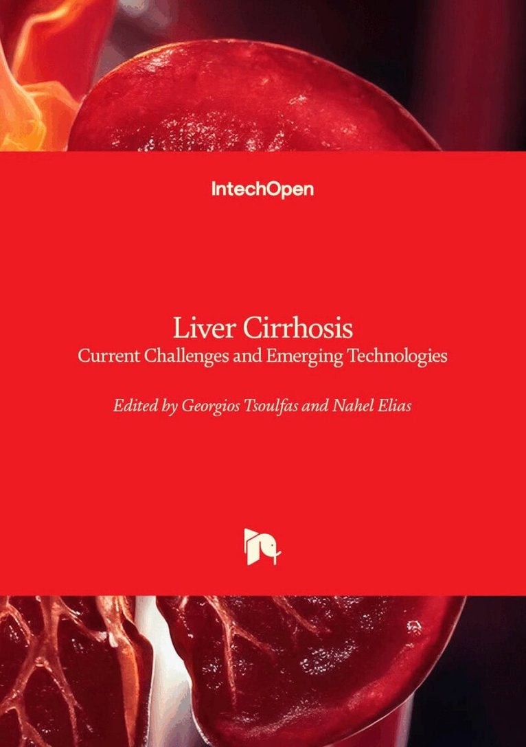 Nahel Elias, Georgios Tsoulfas - Liver Cirrhosis, Inbunden. Tillgänglighet: Lägg i varukorg