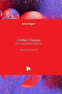 Partha Pal - Crohn’s Disease, Inbunden. Tillgänglighet: Lägg i varukorg