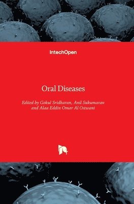 Gokul Sridharan, Anil Sukumaran, Alaa Eddin Omar Al Ostwani - Oral Diseases, Inbunden