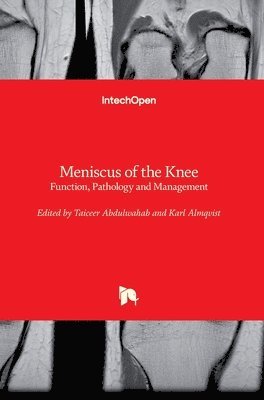 Taiceer Abdulwahab, Karl Almqvist - Meniscus of the Knee, Inbunden. Tillgänglighet: Lägg i varukorg