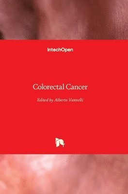 Alberto Vannelli - Colorectal Cancer, Inbunden. Tillgänglighet: Lägg i varukorg