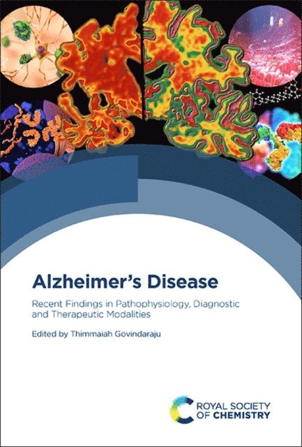 Thimmaiah Govindaraju - Alzheimer's Disease, E-bok