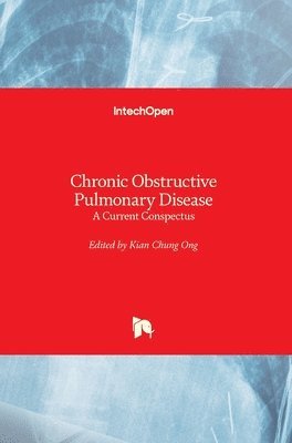 Kian Chung Ong - Chronic Obstructive Pulmonary Disease, Inbunden. Tillgänglighet: Lägg i varukorg
