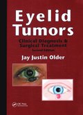 Eyelid Tumors