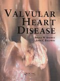 Valvular Heart Disease