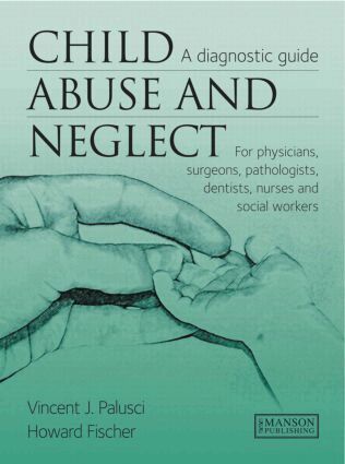 Vincent Palusci, Howard Fischer - Child Abuse & Neglect, Inbunden. Tillgänglighet: Lägg i varukorg