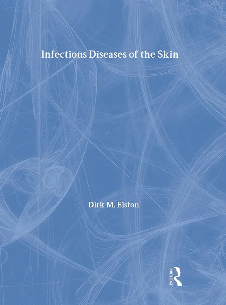 Dirk Elston - Infectious Diseases of the Skin, Häftad. Tillgänglighet: Tillfälligt slut