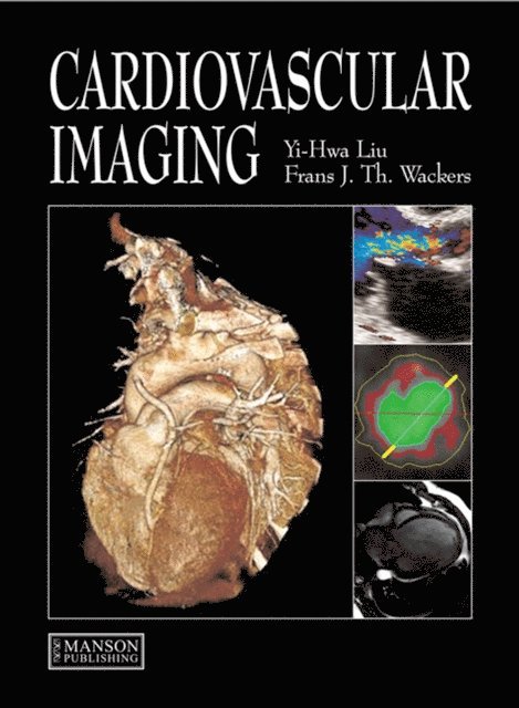 Frans Wackers, Yi-Hwa Liu - Cardiovascular Imaging, E-bok
