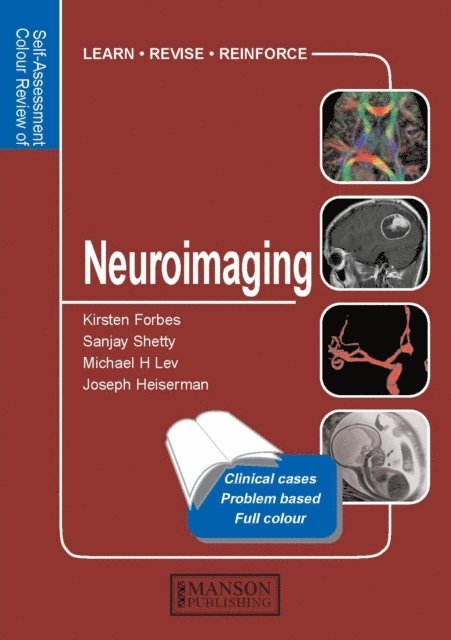 Joseph Heiserman, Michael Lev, Sanjay Shetty, Kirsten Forbes - Neuroimaging, E-bok