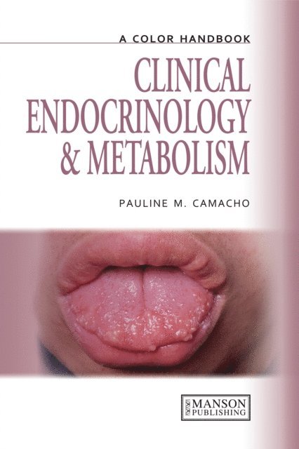 Pauline Camacho - Clinical Endocrinology and Metabolism, E-bok