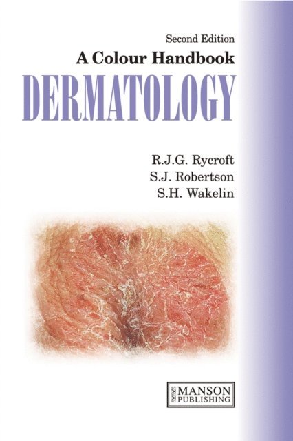 Sarah Wakelin, Stuart Robertson, Richard Rycroft - Dermatology, E-bok