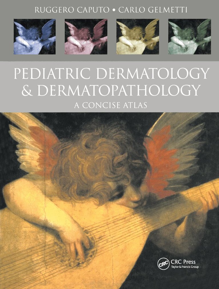 Ruggero Caputo, Carlo Gelmetti - Pediatric Dermatology and Dermatopathology, Inbunden. Tillgänglighet: Lägg i varukorg