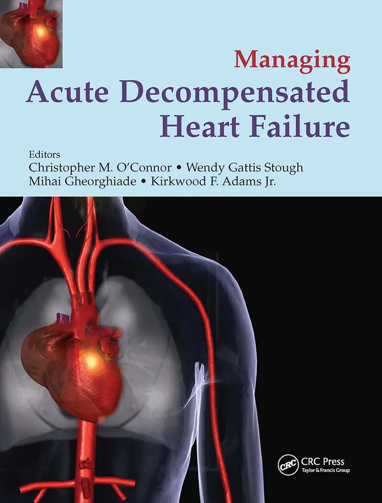 Christopher O'Connor, Wendy Gattis Stough, Miahai Gheorghiade, Kirkwood F. Adams - Management of Acute Decompensated Heart Failure, Inbunden. Tillgänglighet: Tillfälligt slut
