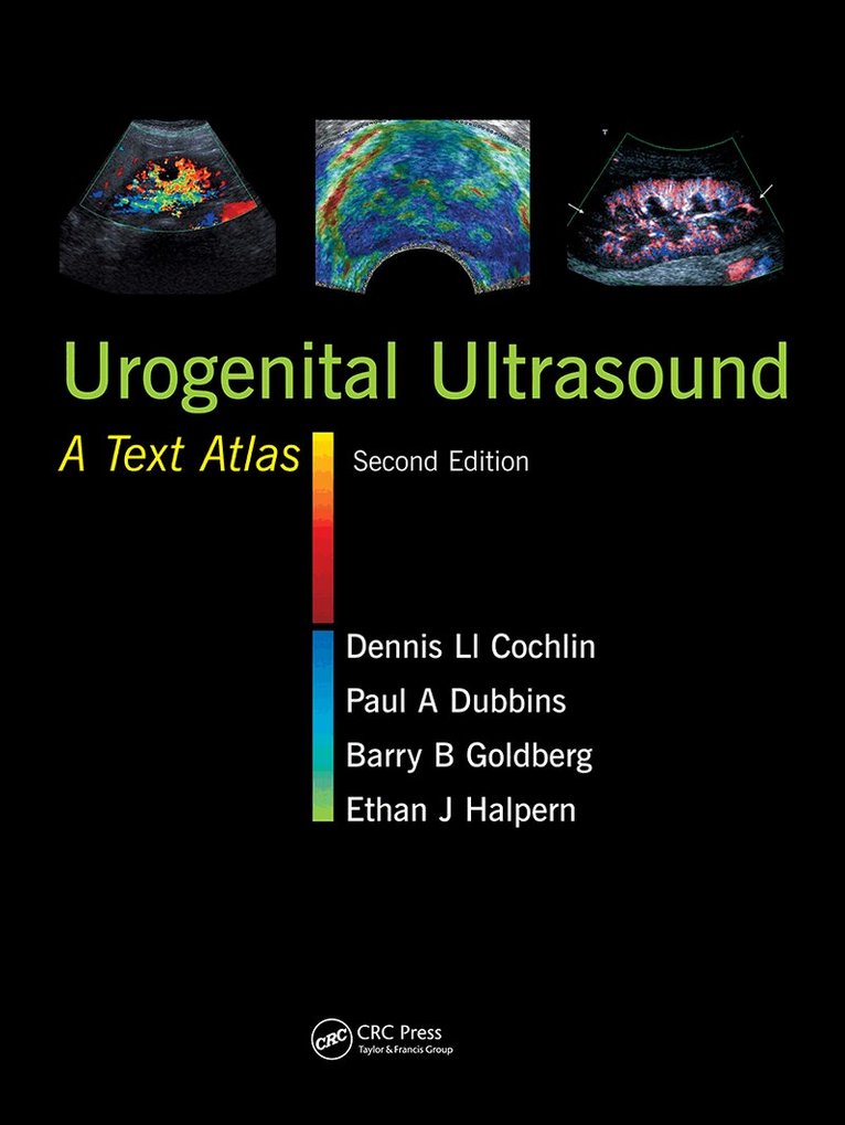 Dennis L. Cochlin, Paul A. Dubbins, Barry B. Goldberg, Ethan J. Halpern - Urogenital Ultrasound, Inbunden. Tillgänglighet: Tillfälligt slut