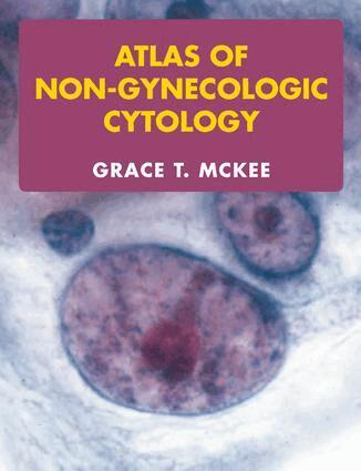 Grace T. McKee - Atlas of Non-Gynecologic Cytology, Inbunden