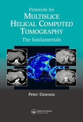 Dawson Peter - Protocols for Multislice Helical Computed Tomography, Inbunden. Tillgänglighet: Lägg i varukorg