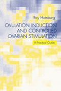 Ovulation Induction and Controlled Ovarian Stimulation