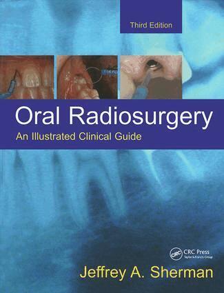 Jeffrey A. Sherman - Oral Radiosurgery, Inbunden. Tillgänglighet: Tillfälligt slut