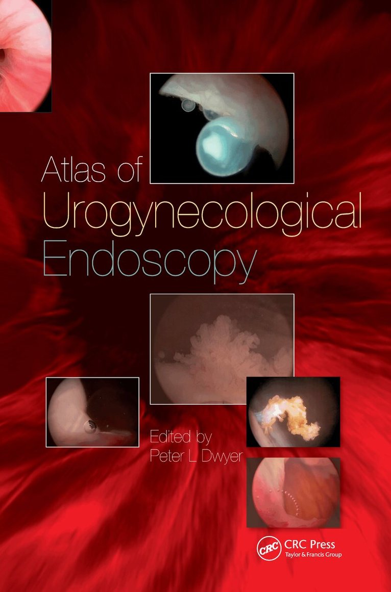 Daniel Rukstalis, Aaron E. Katz - Handbook of Urologic Cryoablation, Inbunden