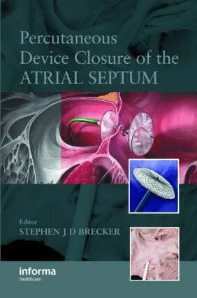 Stephen Brecker - Percutaneous Device Closure of the Atrial Septum, Inbunden. Tillgänglighet: Lägg i varukorg
