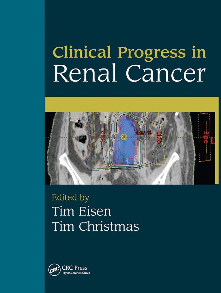 Tim Eisen, Tim Christmas - Clinical Progress in Renal Cancer, Inbunden