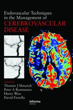 Thomas J. Masaryk, Peter Rasmussen, Henry Woo, David Fiorella - Endovascular Techniques in the Management of Cerebrovascular Disease, Inbunden. Tillgänglighet: Tillfälligt slut