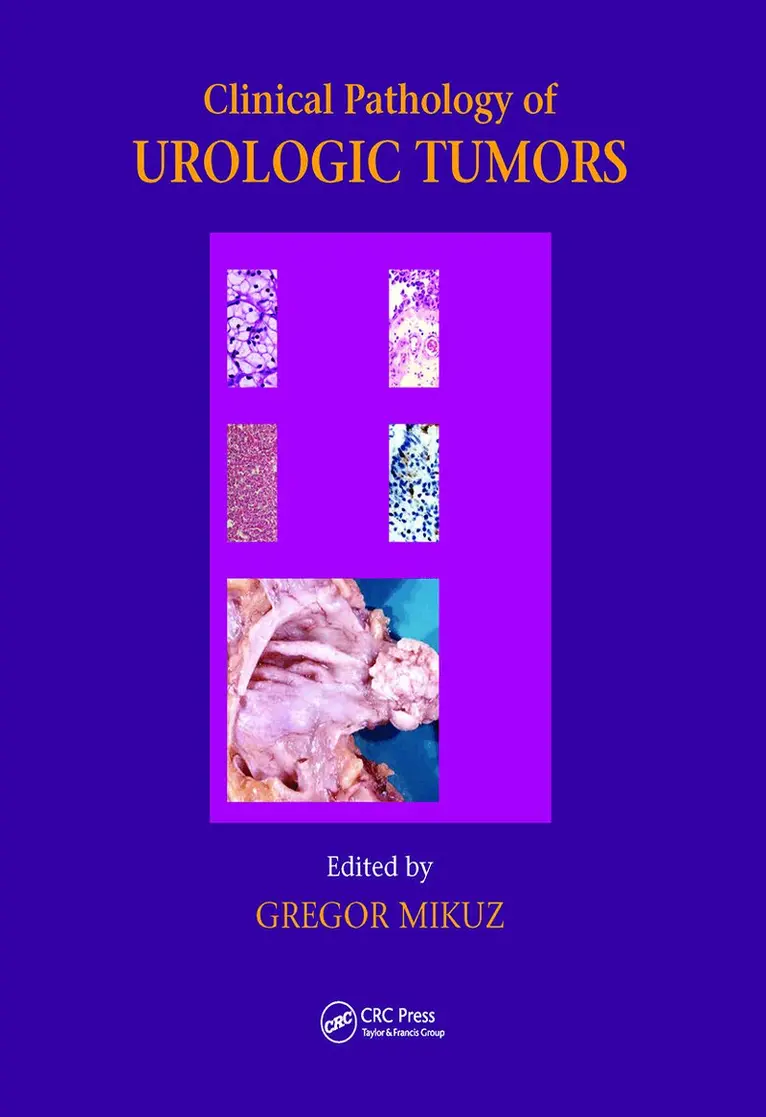 Gregor Mikuz - Clinical Pathology of Urological Tumours, Inbunden. Tillgänglighet: Lägg i varukorg