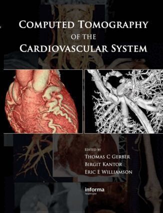 Thomas C. Gerber, Birgit Kantor, Eric E. Williamson - Computed Tomography of the Cardiovascular System, Inbunden