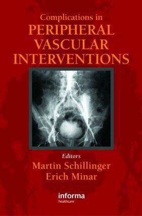 Martin Schillinger, Erich Minar - Complicatons in Peripheral Vascular Interventions, Inbunden. Tillgänglighet: Lägg i varukorg