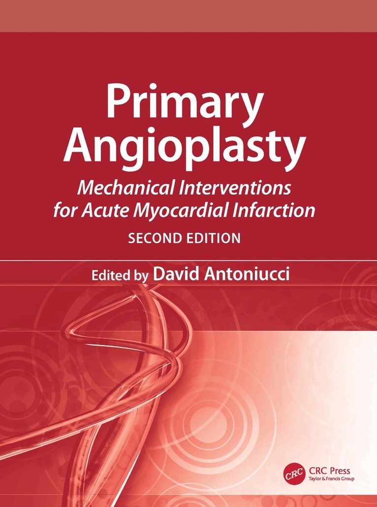 David Antoniucci - Primary Angioplasty, Inbunden. Tillgänglighet: Tillfälligt slut
