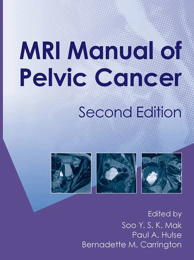 Soo Mak, Paul A. Hulse, B. M. Carrington - MRI Manual of Pelvic Cancer,Second Edition, Inbunden. Tillgänglighet: Tillfälligt slut