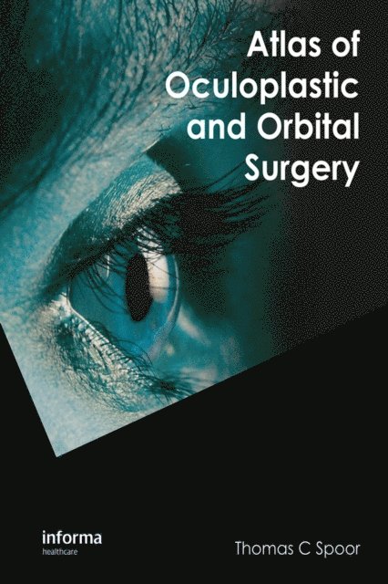Thomas C. Spoor - Atlas of Oculoplastic and Orbital Surgery, E-bok
