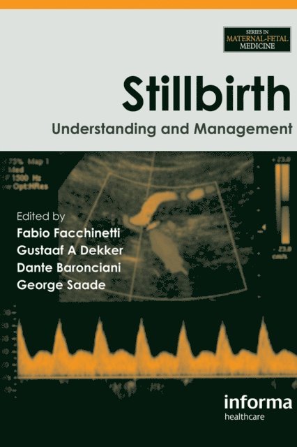 George Saade, Dante Baronciani, Gustaaf Dekker, Fabio Facchinetti - Stillbirth, E-bok