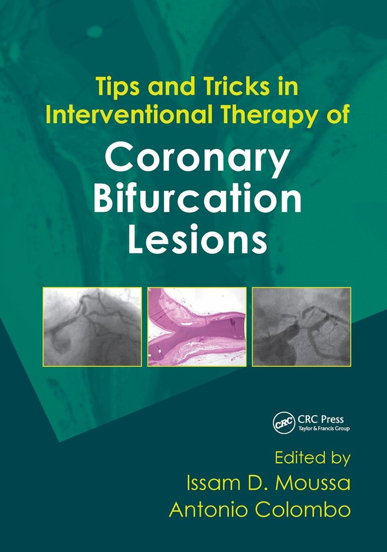 Issam Moussa, Antonio Colombo - Tips and Tricks in Interventional Therapy of Coronary Bifurcation Lesions, Inbunden. Tillgänglighet: Lägg i varukorg