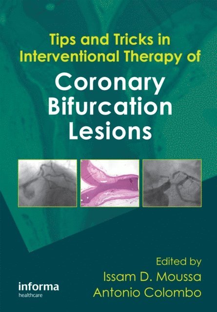 Antonio Colombo, Issam Moussa - Tips and Tricks in Interventional Therapy of Coronary Bifurcation Lesions, E-bok. Tillgänglighet: Lägg i varukorg