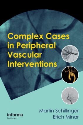 Martin Schillinger, Erich Minar - Complex Cases in Peripheral Vascular Interventions, Inbunden. Tillgänglighet: Lägg i varukorg