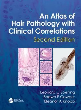 Leonard C Sperling, Shawn E. Cowper, Eleanor A. Knopp - Atlas of Hair Pathology with Clinical Correlations, Inbunden. Tillgänglighet: Lägg i varukorg