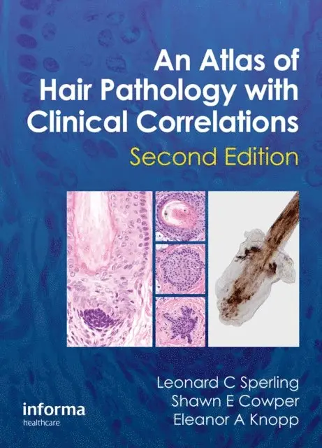 Eleanor A. Knopp, Shawn E. Cowper, Leonard C Sperling - Atlas of Hair Pathology with Clinical Correlations, E-bok. Tillgänglighet: Lägg i varukorg